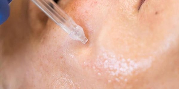 jetpeel swiss esthetic sanary institut beaute sanary-sur-mer